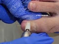 チョガプ(爪、足爪)スケーリング爪水虫専門管理ショップㅣ金浦ただあなたフットアンドネイル チョガプ(爪、足爪)スケーリング爪水虫専門管理ショップㅣ金浦ただあなたフットアンドネイル